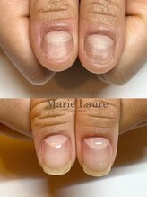 マリーロール 淀屋橋本店(Marie Laure)/自爪育成/深爪矯正/ネイルケア