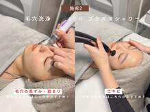 ベル 渋谷(belle)/選べる施術2