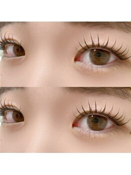 フルールシュア(fleur sr.)/中顔面短縮セット☆パリエク