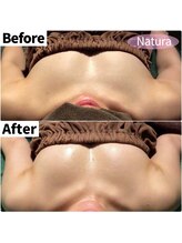 ナトゥーラ 心斎橋なんば本店(Natura)/ボリューム感さらにUP★心斎橋