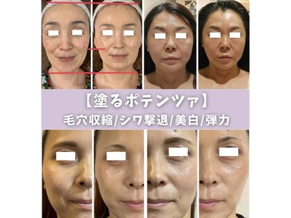 エルアイビー レディー(L.I.B Lady)の写真