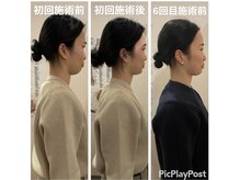 カワル整体 上通り院/姿勢で人相も変わります。