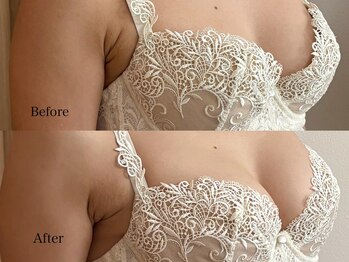 育乳整体&バストアップ専門店 Laurino salon【バストアップ/整体/姿勢改善/産後】/姿勢が変わるとバストアップに☆