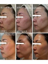 リレフー(Relafy)/★美肌★