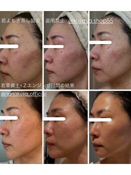 リレフー(Relafy)/★美肌★