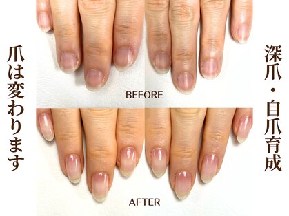 ネイル アンチュ(Nail Anchu)の写真