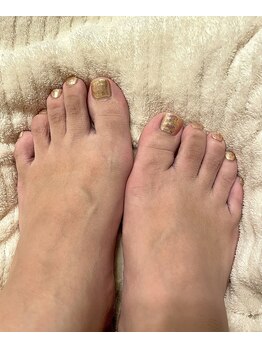 テンネイル(ten. nail)/デザインフット