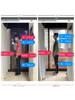 ナオル整体 大森店(NAORU整体)/30代男性、継続施術3ヶ月経過後