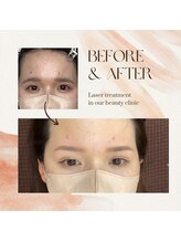 ユアアイサロン(ur.eyesalon)/眉毛Wax