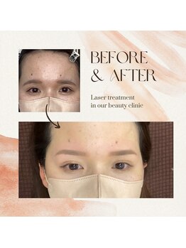 ユアアイサロン(ur.eyesalon)/眉毛Wax