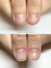 マリーロール 梅田店(Marie Laure)/自爪育成/深爪矯正/ネイルケア