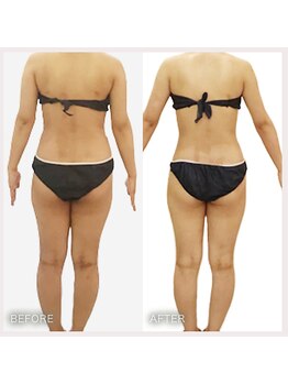 えすてさろん ケイアンドエフ(k&f)/自分史上最高のボディに変身20代