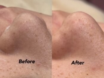 クイーン(QUEEN)/ワンランク上のお肌へ