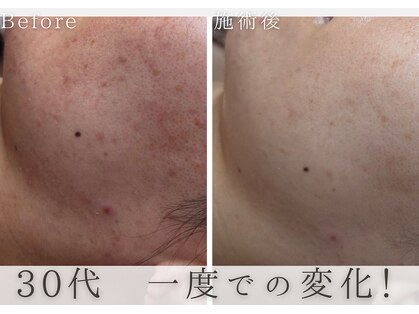 アルム(Areum)の写真