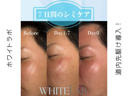 ベル(BELLE)の写真