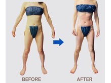 初回から効果を実感♪驚きの効果をご体感ください！