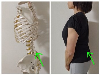 とも整体院の写真/赤坂駅チカ◎おしりの位置アップ↑骨盤矯正でばっちり叶えます！】歪みを改善し腰痛知らずに☆