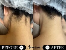 アングレイス(Anngrace)/