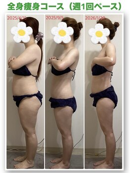 BEAUTYSALONカトレア獨協大学前店【3/5 NEW OPEN(予定)】/★全身痩身★