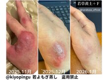 リレフー(Relafy)/★美肌★