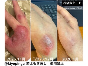 リレフー(Relafy)/★美肌★