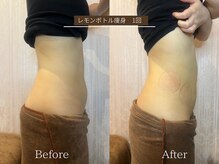 スマイルビューティラボ 別府店(Smile Beauty lab.)の雰囲気（お腹周り【レモンボトル痩身◎】Before /After）
