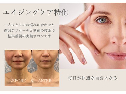 グロッシー(glossy)の写真