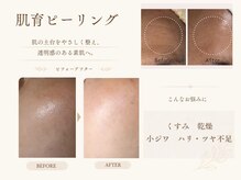 ソワンプラス(soin+)
