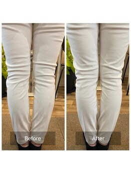 いがらし整体院/О脚の改善もおまかせください!