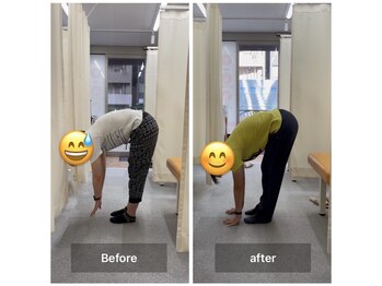 ナオル整体 飯田橋院(NAORU整体)/Before After/飯田橋