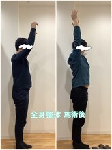 スカイ 鍼灸整骨院 整体院(SKY)/全身美容整体