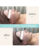 ポノ(PONO)/ポノ☆美顔光フェイシャル