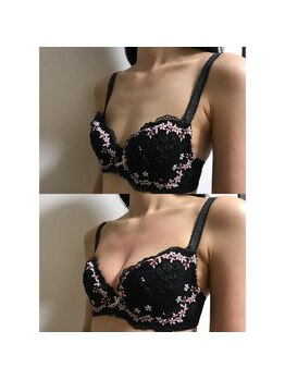 カリス(CHARIS)/バストアップ成功!