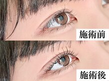 ドルチェ(Dolce)/まつげパーマ専門店