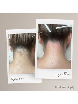 ブラジリアンワキシング シックスナイン(BrazilianWaxing69)/女性 / うなじ