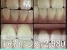 【セルフホワイトニング】メンズ・レディース 60分