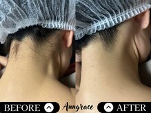 アングレイス(Anngrace)/