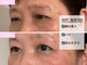 サブリエ(Sablier)の写真