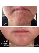 リレフー(Relafy)/★美肌★