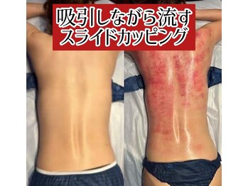 ココ(CoCo)/スライドカッピング