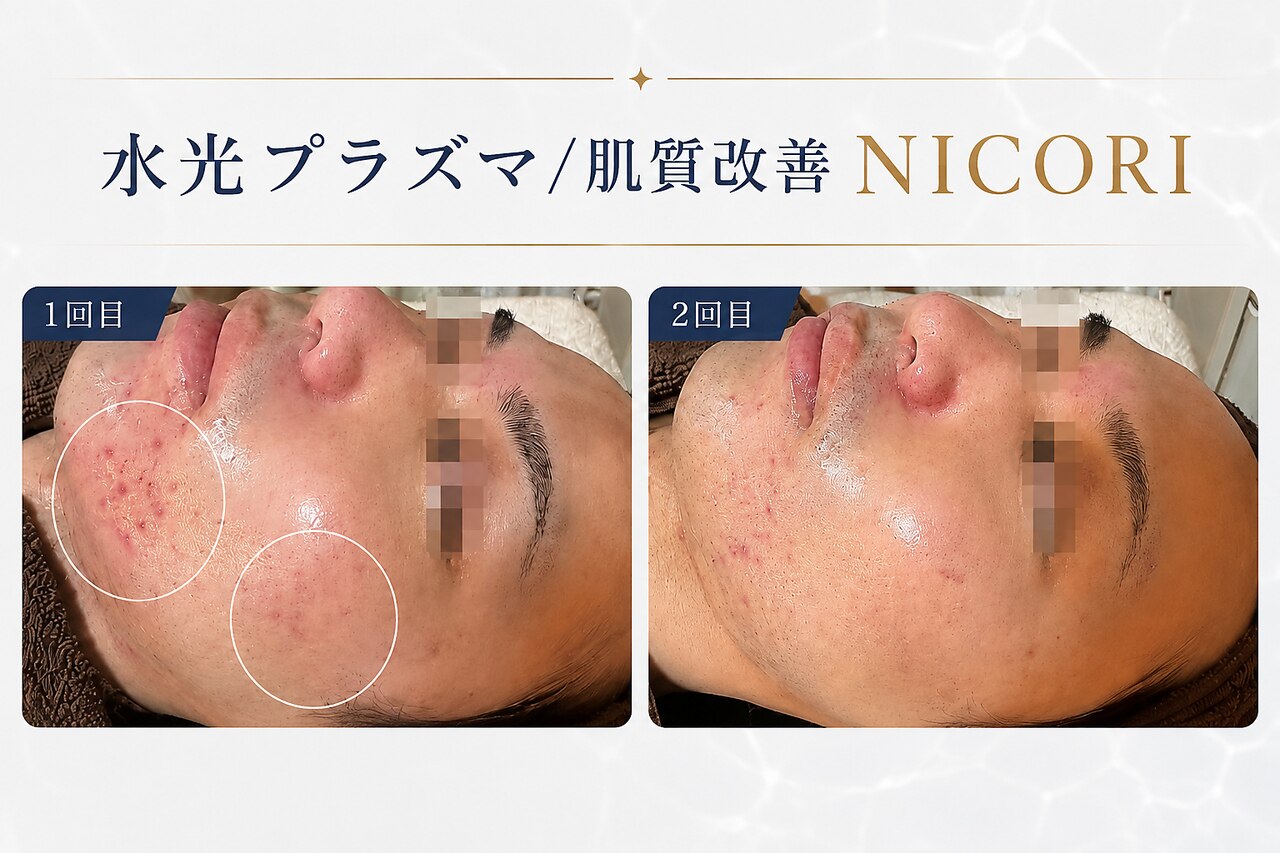 ニコリ 大宮(NICORI)｜ホットペッパービューティー