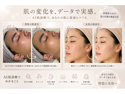 肌イズム 守谷店(肌ism)の写真