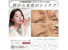 グランヴェルジェ(Granverger)の雰囲気（シミケアもお任せください！）