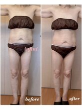 アンフィニ(infini)/短期集中全身5回コース（2ヶ月）