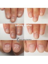 オハナ(OHANA)/自爪育成★爪質改善