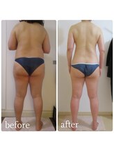 加圧ビューティーサロン スタイル エム(beauty salon style M)/50代/加圧×痩身リンパ120分