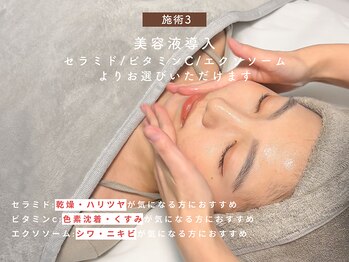 ベル 渋谷(belle)/選べる施術3