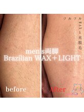 グルーミー(gloomy)/暑い季節に向けて★両脚の脱毛！