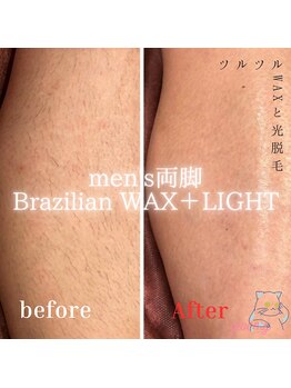 グルーミー(gloomy)/暑い季節に向けて★両脚の脱毛！