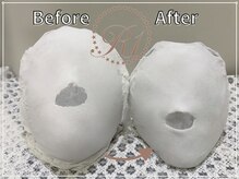 R-1ビューティーサロン 銀座/BEFORE＆AFTER